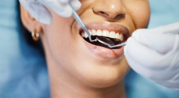 Best Chipped Tooth Repair Near Me  in Oakdale, CA
